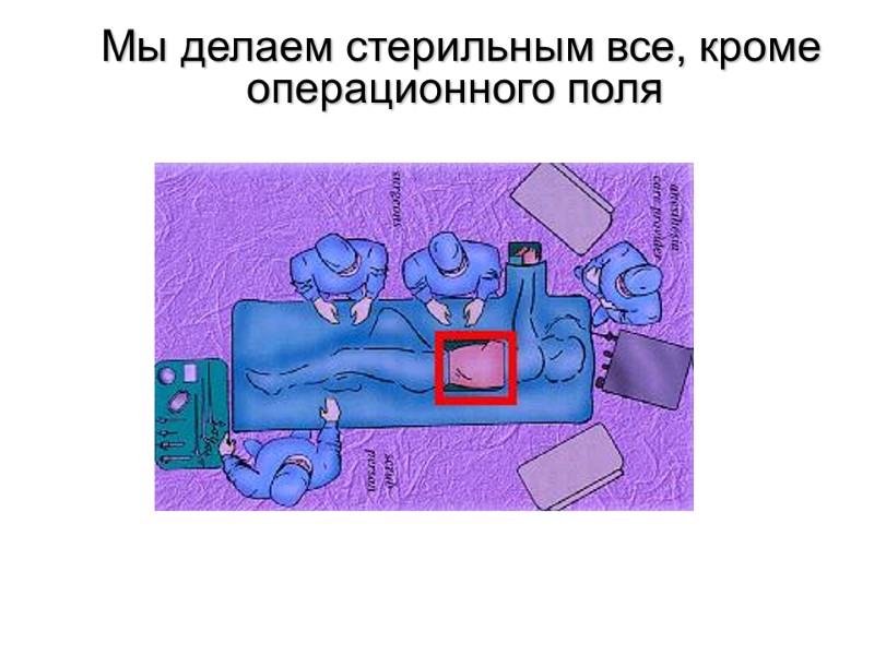 Мы делаем стерильным все, кроме операционного поля